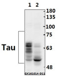 Western blot (WB) analysis of Tau (V398) polyclonal antibody at 1:500 dilution
Lane1:The Brain tissue lysate of Rat(40ug)
Lane2:The Brain tissue lysate of Mouse(40ug)