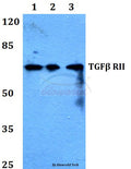 Western blot (WB) analysis of TGFβ RII (I122) polyclonal antibody at 1:500 dilution
Lane1:Hela whole cell lysate
Lane2:Raw264.7 whole cell lysate
Lane3:H9C2 whole cell lysate