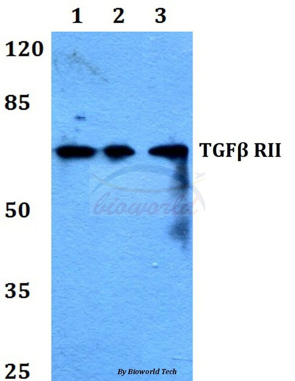 Western blot (WB) analysis of TGFβ RII (I122) polyclonal antibody at 1:500 dilution
Lane1:Hela whole cell lysate
Lane2:Raw264.7 whole cell lysate
Lane3:H9C2 whole cell lysate