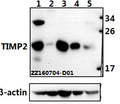 Western blot (WB) analysis of TIMP2 (A47) polyclonal antibody at 1:500 dilution
Lane1:Hela whole cell lysate(40ug)
Lane2:HEK293T whole cell lysate(40ug)
Lane3:The lung tissue lysate of Mouse(40ug)
Lane4:The lung tissue lysate of Rat(40ug)
Lane5:The placenta tissue lysate of Rat(40ug)