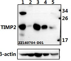 Western blot (WB) analysis of TIMP2 (A47) polyclonal antibody at 1:500 dilution
Lane1:Hela whole cell lysate(40ug)
Lane2:HEK293T whole cell lysate(40ug)
Lane3:The lung tissue lysate of Mouse(40ug)
Lane4:The lung tissue lysate of Rat(40ug)
Lane5:The placenta tissue lysate of Rat(40ug)