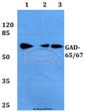 Western blot (WB) analysis of GAD-65/67 (D572) polyclonal antibody at 1:500 dilution
Lane1:HEK293T whole cell lysate
Lane2:NIH-3T3 whole cell lysate
Lane3:H9C2 whole cell lysate