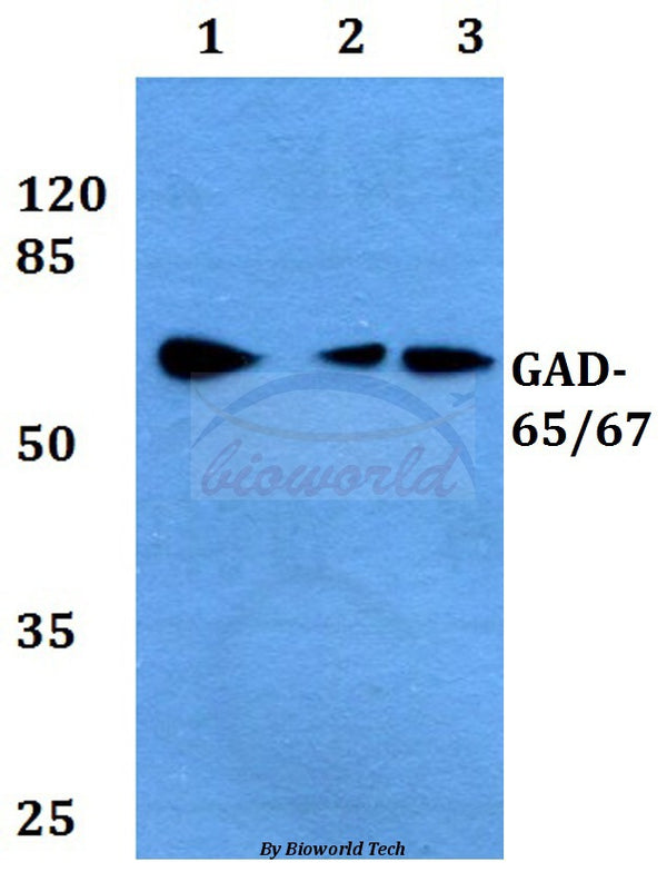 Western blot (WB) analysis of GAD-65/67 (D572) polyclonal antibody at 1:500 dilution
Lane1:HEK293T whole cell lysate
Lane2:NIH-3T3 whole cell lysate
Lane3:H9C2 whole cell lysate