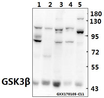 Western blot (WB) analysis of GSK3β (S2) polyclonal antibody at 1:500 dilution
Lane1:H9C2 whole cell lysate(40ug)
Lane2:CT26 whole cell lysate(40ug)
Lane3:COS-7 whole cell lysate(40ug)
Lane4:L02 whole cell lysate(40ug)
Lane5:HEK293T whole cell lysate(40ug)