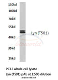 Western blot (WB) analysis of Lyn (T501) polyclonal antibody in extracts from PC12 cells.