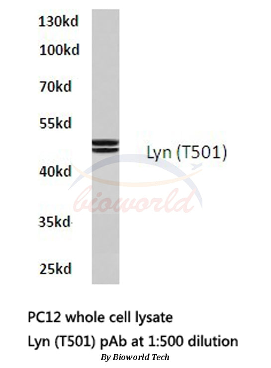 Western blot (WB) analysis of Lyn (T501) polyclonal antibody in extracts from PC12 cells.