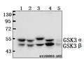 Western blot (WB) analysis of GSK3α/β (G273) polyclonal antibody at 1:500 dilution
Lane1:HEK293T whole cell lysate(40ug)
Lane2:A549 whole cell lysate(40ug)
Lane3:CT26 whole cell lysate(40ug)
Lane4:C6 whole cell lysate(40ug)
Lane5:The Heart tissue lysate of Rat(10ug)