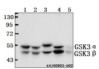 Western blot (WB) analysis of GSK3α/β (G273) polyclonal antibody at 1:500 dilution
Lane1:HEK293T whole cell lysate(40ug)
Lane2:A549 whole cell lysate(40ug)
Lane3:CT26 whole cell lysate(40ug)
Lane4:C6 whole cell lysate(40ug)
Lane5:The Heart tissue lysate of Rat(10ug)