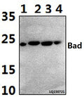 Western blot (WB) analysis of Bad (R149) polyclonal antibody at 1:500 dilution
Lane1:HEK293T whole cell lysate(40ug)
Lane2:MCF-7 whole cell lysate(40ug)
Lane3:SP2/0 whole cell lysate(40ug)
Lane4:H9C2 whole cell lysate(40ug)