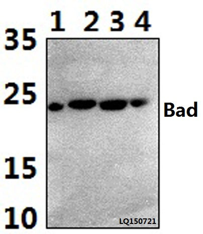 Western blot (WB) analysis of Bad (R149) polyclonal antibody at 1:500 dilution
Lane1:HEK293T whole cell lysate(40ug)
Lane2:MCF-7 whole cell lysate(40ug)
Lane3:SP2/0 whole cell lysate(40ug)
Lane4:H9C2 whole cell lysate(40ug)