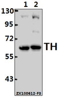 Western blot (WB) analysis of TH (Q25) pAb at 1:2000 dilution
Lane1:The Heart tissue lysate of Mouse(40ug)
Lane2:The Heart tissue lysate of Rat(40ug)