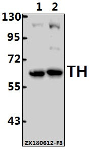 Western blot (WB) analysis of TH (Q25) pAb at 1:2000 dilution
Lane1:The Heart tissue lysate of Mouse(40ug)
Lane2:The Heart tissue lysate of Rat(40ug)