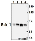 Western blot (WB) analysis of Rsk-1 (T353)  pAb at 1:2000 dilution
Lane1:C6 whole cell lysate(40ug)
Lane2:HCT116 whole cell lysate(40ug)
Lane3:Jurkat whole cell lysate(40ug)                                                                                           
Lane4:H1792 whole cell lysate(40ug)