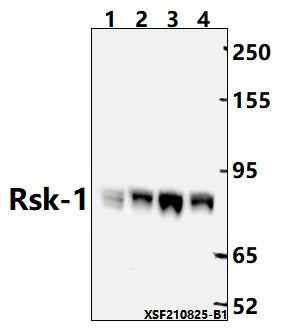 Western blot (WB) analysis of Rsk-1 (T353)  pAb at 1:2000 dilution
Lane1:C6 whole cell lysate(40ug)
Lane2:HCT116 whole cell lysate(40ug)
Lane3:Jurkat whole cell lysate(40ug)                                                                                           
Lane4:H1792 whole cell lysate(40ug)