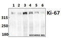 Western blot (WB) analysis of Ki-67 (V3242) pAb at 1:500 dilution
Lane1:HCT116 whole cell lysate(40ug)
Lane2:U-87MG whole cell lysate(40ug)
Lane3:HepG2 whole cell lysate(40ug)
Lane4:L02 whole cell lysate(40ug)
Lane5:SK-OVCAR3 whole cell lysate(40ug)
Lane6:DLD whole cell lysate(40ug)