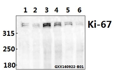Western blot (WB) analysis of Ki-67 (V3242) pAb at 1:500 dilution
Lane1:HCT116 whole cell lysate(40ug)
Lane2:U-87MG whole cell lysate(40ug)
Lane3:HepG2 whole cell lysate(40ug)
Lane4:L02 whole cell lysate(40ug)
Lane5:SK-OVCAR3 whole cell lysate(40ug)
Lane6:DLD whole cell lysate(40ug)