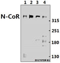 Western blot (WB) analysis of N-CoR (H76) pAb at 1:500 dilution
Lane1:CT26 whole cell lysate(40ug)
Lane2:C6 whole cell lysate(40ug)
Lane3:HepG2 whole cell lysate(40ug)
Lane4:Hela whole cell lysate(40ug)