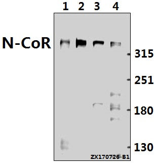Western blot (WB) analysis of N-CoR (H76) pAb at 1:500 dilution
Lane1:CT26 whole cell lysate(40ug)
Lane2:C6 whole cell lysate(40ug)
Lane3:HepG2 whole cell lysate(40ug)
Lane4:Hela whole cell lysate(40ug)