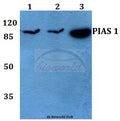 Western blot (WB) analysis of PIAS 1 (G24) polyclonal antibody at 1:500 dilution
Lane1:MCF-7 whole cell lysate
Lane2:Raw264.7 whole cell lysate
Lane3:H9C2 whole cell lysate