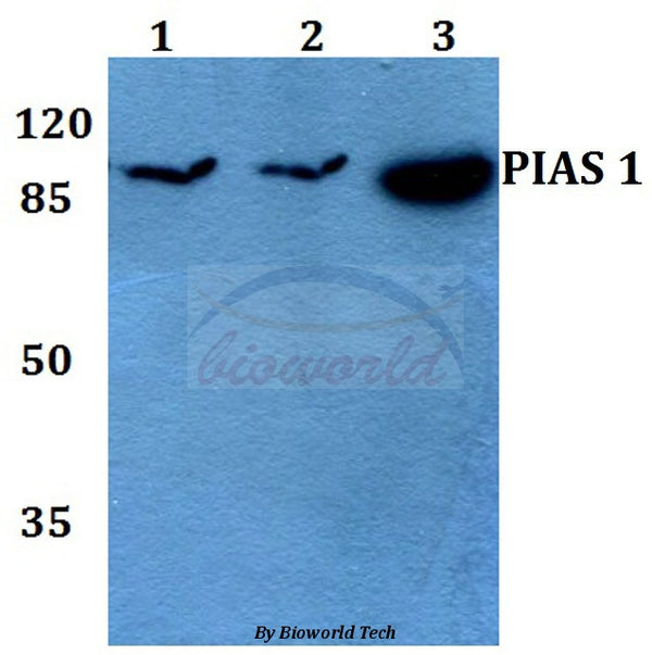 Western blot (WB) analysis of PIAS 1 (G24) polyclonal antibody at 1:500 dilution
Lane1:MCF-7 whole cell lysate
Lane2:Raw264.7 whole cell lysate
Lane3:H9C2 whole cell lysate
