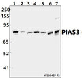 PIAS3 (F25) polyclonal antibody - Figure 1 of 1