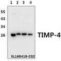 Western blot (WB) analysis of TIMP-4 (S206) polyclonal antibody at 1:500 dilution
Lane1:HEK293T whole cell lysate(40ug)
Lane2:H9C2 whole cell lysate(40ug)
Lane3:The Heart tissue lysate of Rat(40ug)
Lane4:The Heart tissue lysate of Mouse(40ug)
