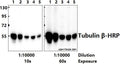 Western blot (WB) analysis of Tubulin β (4D9) monoclonal antibody-HRP at 1:10000 dilution
Lane1:The Brain tissue lysate of Rat(10ug)
Lane2:The Brain tissue lysate of Mouse(10ug)
Lane3:PC12 whole cell lysate(10ug)
Lane4:BV2 whole cell lysate(10ug)
Lane5:A549 whole cell lysate(10ug)
