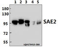Western blot (WB) analysis of SAE2 (S621) polyclonal antibody at 1:500 dilution
Lane1:A549 whole cell lysate(40ug)
Lane2:HEK293T whole cell lysate(40ug)
Lane3:H1792 whole cell lysate(40ug)
Lane4:PC12 whole cell lysate(40ug)
Lane5:BV2 whole cell lysate(40ug)