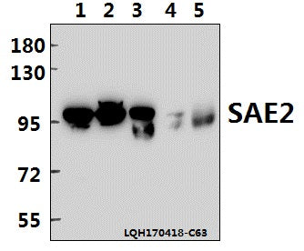 Western blot (WB) analysis of SAE2 (S621) polyclonal antibody at 1:500 dilution
Lane1:A549 whole cell lysate(40ug)
Lane2:HEK293T whole cell lysate(40ug)
Lane3:H1792 whole cell lysate(40ug)
Lane4:PC12 whole cell lysate(40ug)
Lane5:BV2 whole cell lysate(40ug)