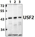Western blot (WB) analysis of USF2 (D226) polyclonal antibody at 1:500 dilution                                                                                                                                                                                                                                                                                                                                                                                        Lane1:A549 whole cell lysate(40ug)
Lane2:PC12