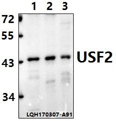 Western blot (WB) analysis of USF2 (D226) polyclonal antibody at 1:500 dilution                                                                                                                                                                                                                                                                                                                                                                                        Lane1:A549 whole cell lysate(40ug)
Lane2:PC12