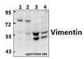 Western blot (WB) analysis of Vimentin (I444) polyclonal antibody at 1:500 dilution                                                                                                                                                                                                                                                                                                                                                                                        Lane1:MCF-7 whole cell lysate(40ug)
Lane2