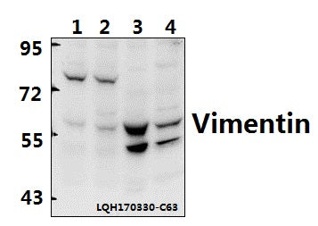 Western blot (WB) analysis of Vimentin (I444) polyclonal antibody at 1:500 dilution                                                                                                                                                                                                                                                                                                                                                                                        Lane1:MCF-7 whole cell lysate(40ug)
Lane2