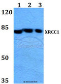 Western blot (WB) analysis of XRCC1 (G552) polyclonal antibody at 1:500 dilution
Lane1:HepG2 whole cell lysate
Lane2:Raw264.7 whole cell lysate
Lane3:H9C2 whole cell lysate