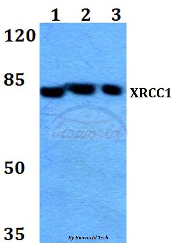Western blot (WB) analysis of XRCC1 (G552) polyclonal antibody at 1:500 dilution
Lane1:HepG2 whole cell lysate
Lane2:Raw264.7 whole cell lysate
Lane3:H9C2 whole cell lysate