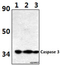 Western blot (WB) analysis of Caspase 3 (D146) polyclonal antibody at 1:500 dilution
Lane1:Hela whole cell lysate(40ug)
Lane2:Hela treated with H2O2 (100nmol/ml, 25min, Na3O4V) whole cell lysate (40ug)
Lane3:Hela treated with H2O2 (100nmol/ml, 25min, λ-ppase) whole cell lysate (40ug)