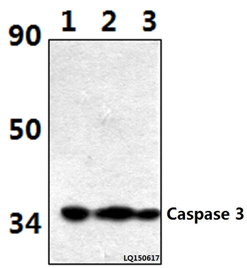 Western blot (WB) analysis of Caspase 3 (D146) polyclonal antibody at 1:500 dilution
Lane1:Hela whole cell lysate(40ug)
Lane2:Hela treated with H2O2 (100nmol/ml, 25min, Na3O4V) whole cell lysate (40ug)
Lane3:Hela treated with H2O2 (100nmol/ml, 25min, λ-ppase) whole cell lysate (40ug)