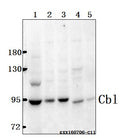 Western blot (WB) analysis of Cbl(G694) polyclonal antibody at 1:500 dilution
Lane1:786-O whole cell lysate(40ug)
Lane2:SK-OVCAR3 whole cell lysate(40ug)
Lane3:MCF-7 whole cell lysate(40ug)
Lane4:The Testis tissue lysate of Mouse(40ug)
Lane5:The Testis tissue lysate of Rat(40ug)