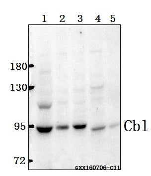 Western blot (WB) analysis of Cbl(G694) polyclonal antibody at 1:500 dilution
Lane1:786-O whole cell lysate(40ug)
Lane2:SK-OVCAR3 whole cell lysate(40ug)
Lane3:MCF-7 whole cell lysate(40ug)
Lane4:The Testis tissue lysate of Mouse(40ug)
Lane5:The Testis tissue lysate of Rat(40ug)
