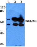 Western blot (WB) analysis of JNK1/2/3 (P184) polyclonal antibody at 1:500 dilution
Lane1:HEK293T whole cell lysate
Lane2:Raw264.7 whole cell lysate
Lane3:H9C2 whole cell lysate