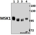 Western blot (WB) analysis of MSK1 (M355) pAb at 1:500 dilution
Lane1:BV2 whole cell lysate(10ug)
Lane2:H9C2 whole cell lysate(40ug)
Lane3:MCF-7 whole cell lysate(40ug)
Lane4:A549 whole cell lysate(40ug)