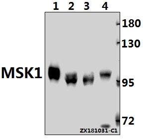 Western blot (WB) analysis of MSK1 (M355) pAb at 1:500 dilution
Lane1:BV2 whole cell lysate(10ug)
Lane2:H9C2 whole cell lysate(40ug)
Lane3:MCF-7 whole cell lysate(40ug)
Lane4:A549 whole cell lysate(40ug)