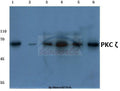 Western blot (WB) analysis of PKC ζ (P556) polyclonal antibody at 1:500 dilution
Lane1:Hela cell lysate
Lane2:NIH-3T3 cell lysate
Lane3:PC12 cell lysate
Lane4:Rat kidney tissue lysate
Lane5:Rat heart tissue lysate