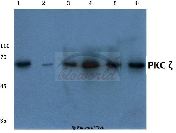 Western blot (WB) analysis of PKC ζ (P556) polyclonal antibody at 1:500 dilution
Lane1:Hela cell lysate
Lane2:NIH-3T3 cell lysate
Lane3:PC12 cell lysate
Lane4:Rat kidney tissue lysate
Lane5:Rat heart tissue lysate