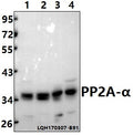 Western blot (WB) analysis of PP2A-α (T301) polyclonal antibody at 1:500 dilution                                                                                                                                                                                                                                                                                                                                                                                        Lane1:Hela whole cell lysate(40ug)
Lane2:CO