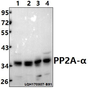 Western blot (WB) analysis of PP2A-α (T301) polyclonal antibody at 1:500 dilution                                                                                                                                                                                                                                                                                                                                                                                        Lane1:Hela whole cell lysate(40ug)
Lane2:CO