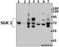 Western blot (WB) analysis of SGK 1 (P73) pAb at 1:500 dilution
Lane1:The Kidney tissue lysate of Mouse(40ug)
Lane2:The Kidney tissue lysate of Rat(40ug)
Lane3:Panc1 whole cell lysate(40ug)
Lane4:A549 whole cell lysate(40ug)
Lane5:3T3-L1 whole cell lysate(40ug)
Lane6:PMVEC whole cell lysate(40ug)
Lane7:HEK293T whole cell lysate(40ug)