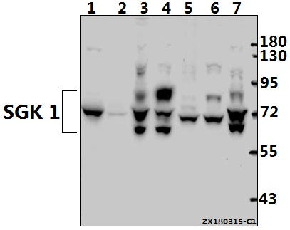 Western blot (WB) analysis of SGK 1 (P73) pAb at 1:500 dilution
Lane1:The Kidney tissue lysate of Mouse(40ug)
Lane2:The Kidney tissue lysate of Rat(40ug)
Lane3:Panc1 whole cell lysate(40ug)
Lane4:A549 whole cell lysate(40ug)
Lane5:3T3-L1 whole cell lysate(40ug)
Lane6:PMVEC whole cell lysate(40ug)
Lane7:HEK293T whole cell lysate(40ug)