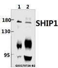 Western blot (WB) analysis of SHIP1 (M1014) pAb at 1:500 dilution
Lane1:HEK293T whole cell lysate(40ug)
Lane2:SK-OVCAR3 whole cell lysate(40ug)