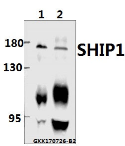 Western blot (WB) analysis of SHIP1 (M1014) pAb at 1:500 dilution
Lane1:HEK293T whole cell lysate(40ug)
Lane2:SK-OVCAR3 whole cell lysate(40ug)